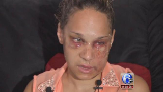 Illustration for article titled Woman Surrenders in Brutal Beating of Mother in Front of 2-Year-Old